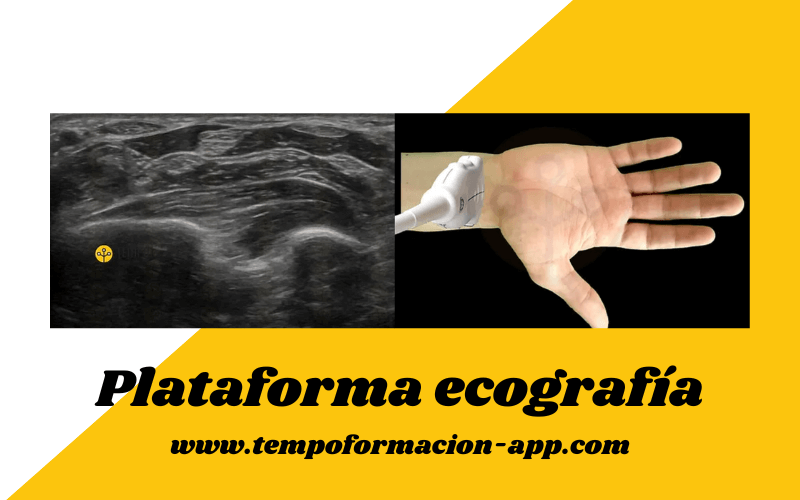 2. Ecografia Tempo Formacion tendones flexores.png